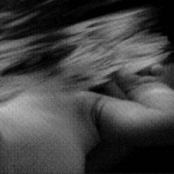 Syndrome (BEL) : Floating Veins